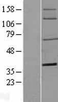 CD73 (NT5E) Human Over-expression Lysate