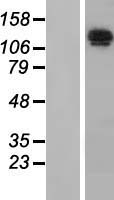 Nardilysin (NRDC) Human Over-expression Lysate