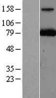 PARN Human Over-expression Lysate