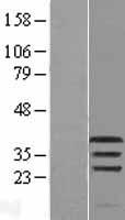 PIM1 Human Over-expression Lysate