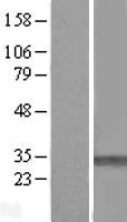 PMM1 Human Over-expression Lysate