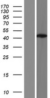 DNA Polymerase beta (POLB) Human Over-expression Lysate