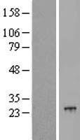 POLR2G Human Over-expression Lysate