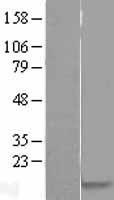 PRM1 Human Over-expression Lysate