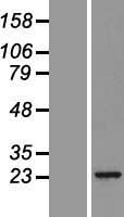 Proteasome subunit beta type 2 (PSMB2) Human Over-expression Lysate