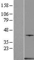 Parvalbumin (PVALB) Human Over-expression Lysate