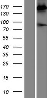 Pregnancy zone protein (PZP) Human Over-expression Lysate