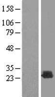 Recoverin (RCVRN) Human Over-expression Lysate