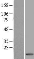 Psoriasin (S100A7) Human Over-expression Lysate