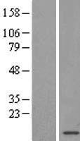 S100A5 Human Over-expression Lysate