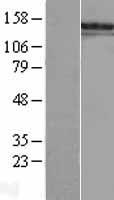 SALL1 Human Over-expression Lysate
