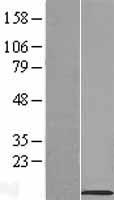 SLN Human Over-expression Lysate