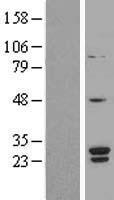 SNRPB2 Human Over-expression Lysate