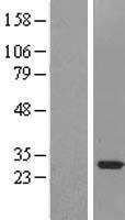 SNRPA1 Human Over-expression Lysate
