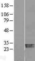 Superoxide Dismutase 3 (SOD3) Human Over-expression Lysate