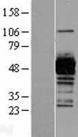 UAP1 Human Over-expression Lysate