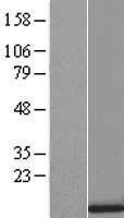 SRP9 Human Over-expression Lysate