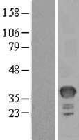 Spermidine synthase (SRM) Human Over-expression Lysate