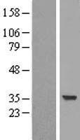 SULT2A1 Human Over-expression Lysate