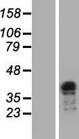 TFIISH (TCEA3) Human Over-expression Lysate