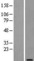 TFF1 Human Over-expression Lysate