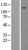 Thrombospondin 2 (THBS2) Human Over-expression Lysate