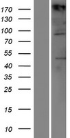 TIAM1 Human Over-expression Lysate