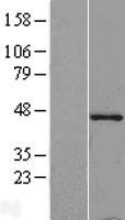 Tropomodulin 1 (TMOD1) Human Over-expression Lysate