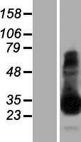 TPSAB1 Human Over-expression Lysate