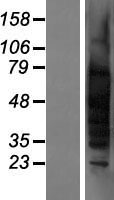 TSPY1 Human Over-expression Lysate
