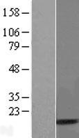 UBA52 Human Over-expression Lysate