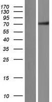 ZNF131 Human Over-expression Lysate