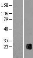 ZP2 Human Over-expression Lysate