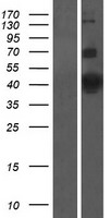 Kv beta 1 (KCNAB1) Human Over-expression Lysate