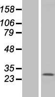 TMEM187 Human Over-expression Lysate
