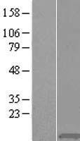 H4C1 Human Over-expression Lysate