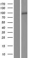 Calcium independent Phospholipase A2 (PLA2G6) Human Over-expression Lysate