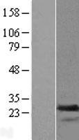 TAGLN2 Human Over-expression Lysate
