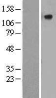 CILP Human Over-expression Lysate