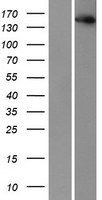 IKAP (IKBKAP) Human Over-expression Lysate