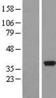 PDXK Human Over-expression Lysate