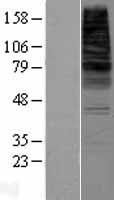 CDS2 Human Over-expression Lysate