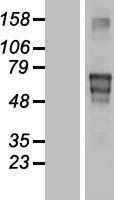 Matrilin 4 (MATN4) Human Over-expression Lysate