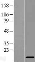 ATP6V1F Human Over-expression Lysate