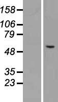 CHST3 Human Over-expression Lysate