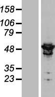 ARHGAP1 Human Over-expression Lysate
