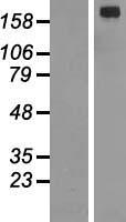 ALK Human Over-expression Lysate