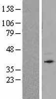 Bone marrow stromal cell antigen 1 (BST1) Human Over-expression Lysate