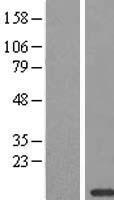 Cytochrome C Oxidase subunit VIc (COX6C) Human Over-expression Lysate