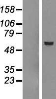GSDME Human Over-expression Lysate